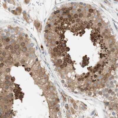 Immunohistochemistry-Paraffin: MANF Antibody [NBP1-90099]