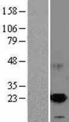 Western Blot: MANF Overexpression Lysate [NBL1-07719]