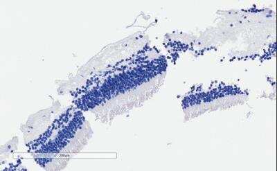 Immunohistochemistry-Paraffin: ARMS2 Antibody [NBP1-52157]