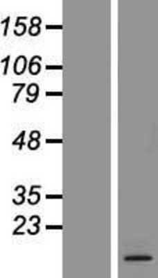 Western Blot: ARMS2 Overexpression Lysate [NBP2-08290]