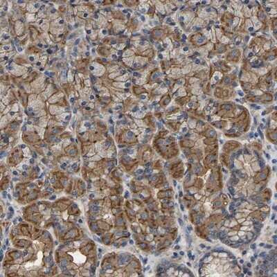 Immunohistochemistry-Paraffin: ARMT1 Antibody [NBP1-82276]