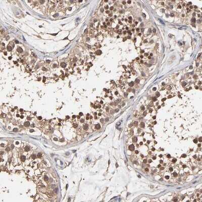 Immunohistochemistry-Paraffin: ARMT1 Antibody [NBP1-82277]
