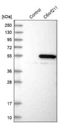 Western Blot: ARMT1 Antibody [NBP1-82276]