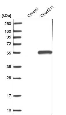 Western Blot: ARMT1 Antibody [NBP1-82277]