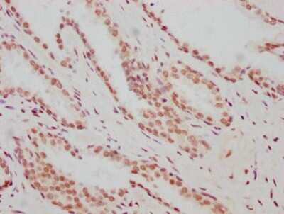 Immunohistochemistry: ARNT/HIF-1 beta Antibody (2F11) [NBP3-15238]