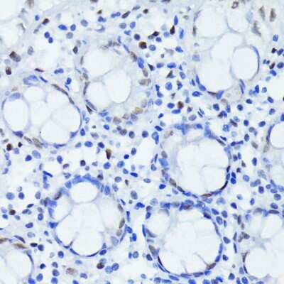 Immunohistochemistry-Paraffin: ARNT/HIF-1 beta Antibody (3R0Y4) [NBP3-15757]