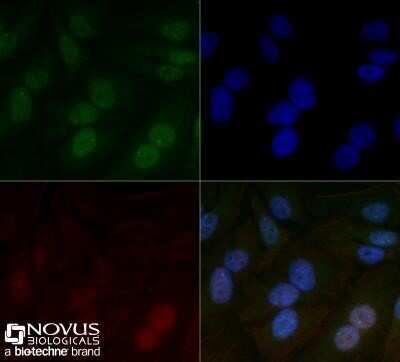 Immunocytochemistry/ Immunofluorescence: ARNT/HIF-1 beta Antibody (H1beta234) - Azide and BSA Free [NBP2-80582]