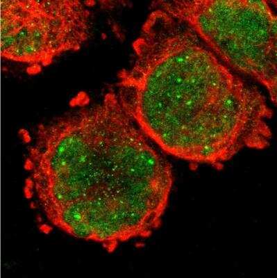 Immunocytochemistry/ Immunofluorescence: ARNT/HIF-1 beta Antibody [NBP2-54663]