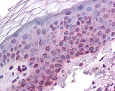 Immunohistochemistry: ARNT/HIF-1 beta Antibody [NB100-110]
