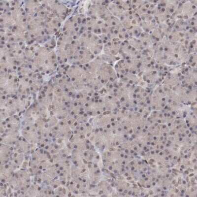 Immunohistochemistry-Paraffin: ARNT/HIF-1 beta Antibody [NBP2-54663]