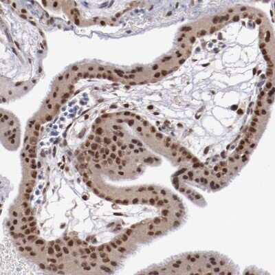 Immunohistochemistry-Paraffin: ARNT/HIF-1 beta Antibody [NBP2-54663]