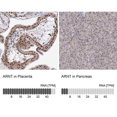 Immunohistochemistry-Paraffin: ARNT/HIF-1 beta Antibody [NBP2-54663]