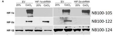 Western Blot: ARNT/HIF-1 beta Antibody Pack [NB100-982]