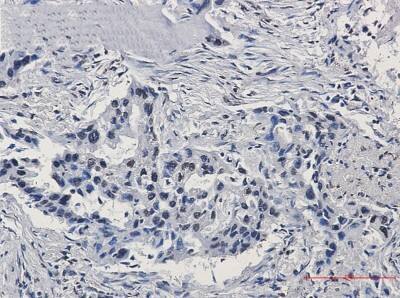 Immunohistochemistry-Paraffin: ARNT/HIF-1 beta Antibody (S05-3B2) [NBP3-20084]