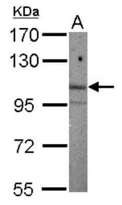 Western Blot: ARNT2 Antibody [NBP2-15469]