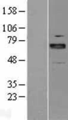 Western Blot: ARNT2 Overexpression Lysate [NBL1-07721]