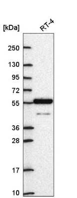 Western Blot: ARNTL2 Antibody [NBP2-55861]