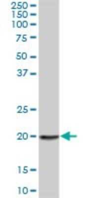 Western Blot: ARP10 Antibody [H00164668-B01P]