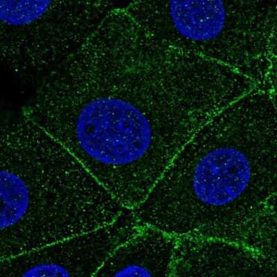 Immunocytochemistry/ Immunofluorescence: ARPC1A Antibody [NBP1-88851]