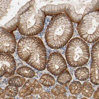 Immunohistochemistry-Paraffin: ARPC1A Antibody [NBP1-88851]