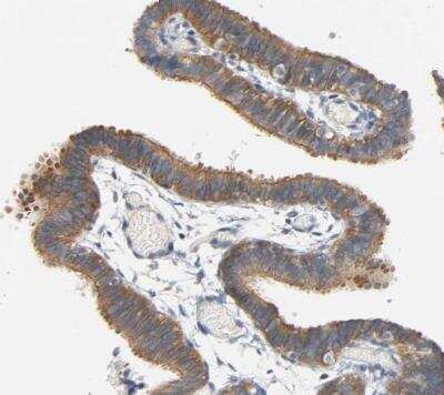 Immunohistochemistry-Paraffin: ARPC1A Antibody [NBP1-88851]