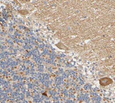 Immunohistochemistry-Paraffin: ARPC1A Antibody [NBP1-88851]