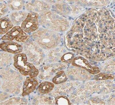 Immunohistochemistry-Paraffin: ARPC1A Antibody [NBP1-88851]