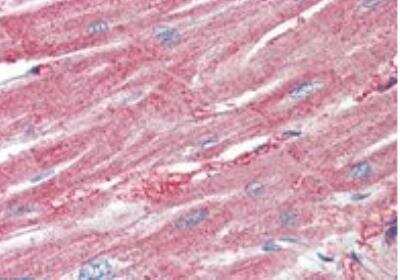 Immunohistochemistry-Paraffin: ARPC1A Antibody [NBP2-11579]