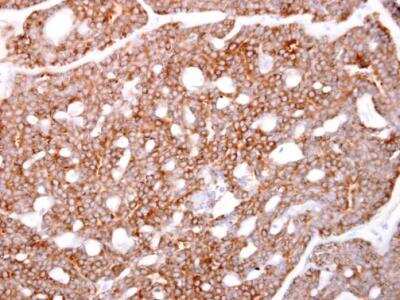 Immunohistochemistry-Paraffin: ARPC1A Antibody [NBP2-15470]