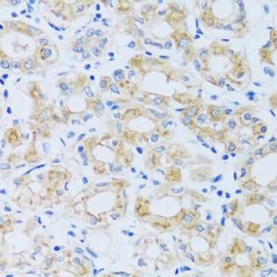 Immunohistochemistry-Paraffin: ARPC1A Antibody - BSA Free [NBP3-04783]