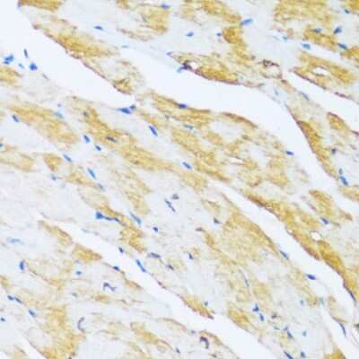 Immunohistochemistry-Paraffin: ARPC1A Antibody - BSA Free [NBP3-04783]