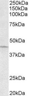 Western Blot: ARPC1A Antibody [NBP2-11579]