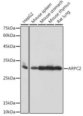 Western Blot: ARPC2 Antibody (4F2G6) [NBP3-15471]