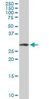Western Blot: ARPC2 Antibody (5C8) [H00010109-M01]