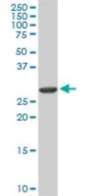 Western Blot: ARPC2 Antibody (5C8) [H00010109-M01]