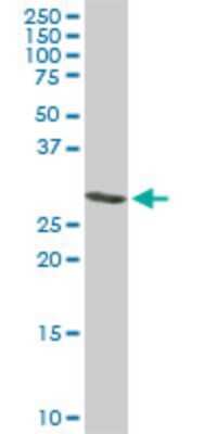 Western Blot: ARPC2 Antibody (5C8) [H00010109-M01]