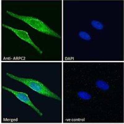 Immunocytochemistry/ Immunofluorescence: ARPC2 Antibody [NB100-1037]