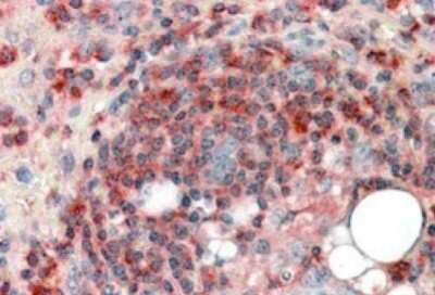 Immunohistochemistry-Paraffin: ARPC2 Antibody [NB100-1037]