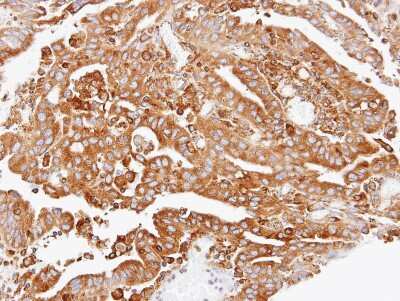 Immunohistochemistry-Paraffin: ARPC2 Antibody [NBP1-32297]