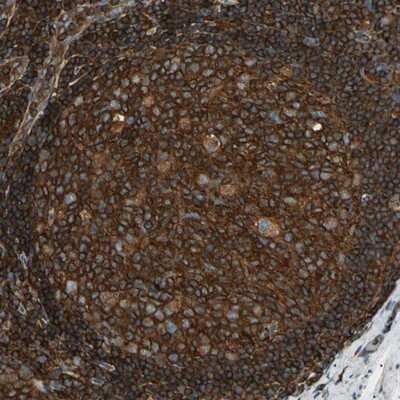 Immunohistochemistry-Paraffin: ARPC2 Antibody [NBP1-88852]