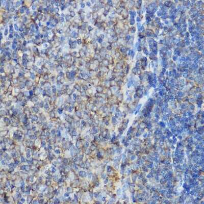 Immunohistochemistry-Paraffin: ARPC2 Antibody - Azide and BSA Free [NBP2-92039]