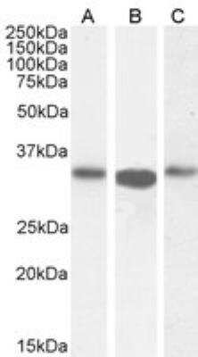 Western Blot: ARPC2 Antibody [NB100-1037]