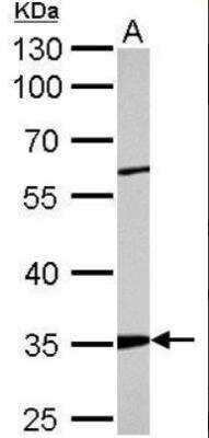 Western Blot: ARPC2 Antibody [NBP1-32297]