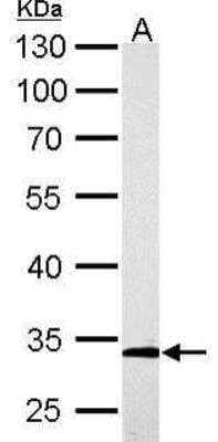 Western Blot: ARPC2 Antibody [NBP1-32297]