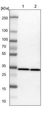 Western Blot: ARPC2 Antibody [NBP1-88852]