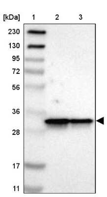 Western Blot: ARPC2 Antibody [NBP1-88852]