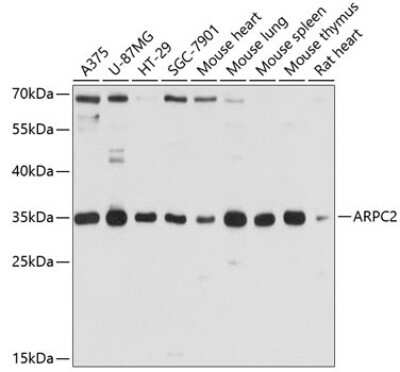 Western Blot: ARPC2 AntibodyAzide and BSA Free [NBP2-92039]