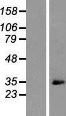 Western Blot: ARPC2 Overexpression Lysate [NBP2-05285]