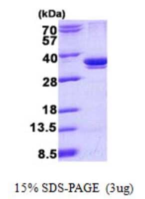 SDS-PAGE: Recombinant Human ARPC2 His Protein [NBP2-22668]