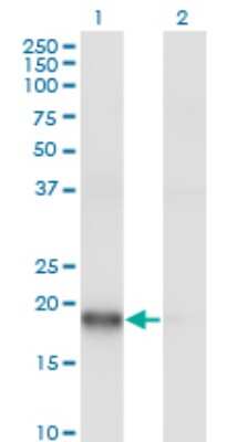 Western Blot: ARPC3 Antibody (2E11) [H00010094-M06]